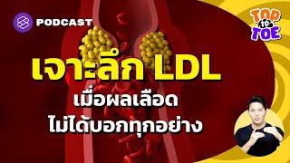 จัดการ Small Dense LDL ภัยร้ายโรคหัวใจ  Top to Toe EP.76