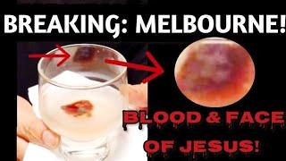 Breaking Alleged Eucharistic Miracle in Melbourne  Bleeding Host & Bloody Face of Jesus