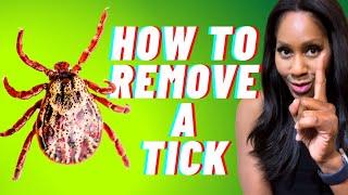 How to REMOVE A TICK A Doctor Demonstrates