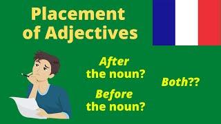 Placement of Adjectives in French