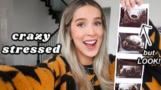 A VERY STRESSFUL MOMENT my first ultrasound & biggest relief  leighannvlogs