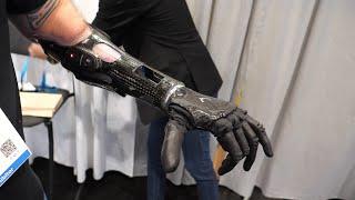 Psyonic - Touch-Sensing Bionic Ability Hand - Interview - CES 2022 - Poc Network