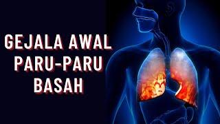 5 Gejala Paru-Paru Basah yang Harus Diwaspadai