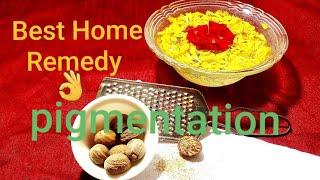 #nutmeg  simple remedy but affective result #best homeremedy acnefinelines #pigmentation #jaiphal