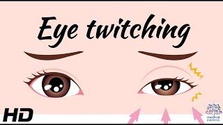 The Science Behind Eyelid Twitching Explained