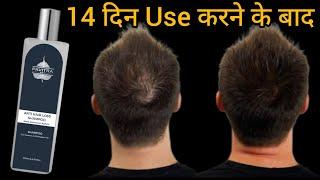 14 दिन बालो को धोने के बाद ? Pavitra Anti Hair Loss Shampoo