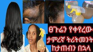 ፀጉራችን #እንዳይረግፍ እንዲፋፋ #በፍጥነት እዲያድግ ለወዙ በሳምንት #ለውጥ የሚያሳይ ምርጥ #ትሪትመንት