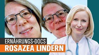 Rosazea erkennen und heilen Was hilft bei Entzündungen im Gesicht?  Die Ernährungs-Docs  NDR