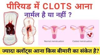 Periods me Clot kyun aate hain  Clots in Periods  मसिक में खून के थक्के कारण और इलाज @Narijivan