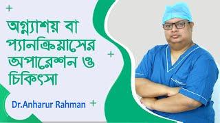 অগ্ন্যাশয় বা প্যানক্রিয়াস ক্যান্সারের অপারেশন ও চিকিৎসা  Pancreatic Cancer  Bangla Health Tips