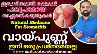 വായ്പുണ്ണ് മാറാൻ  %  Mouth ulcer home remedies malayalam  Stomatitis Home Treatment malayalam 