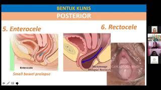 Bimbingan POP Prolapsus Organ Panggul Pelvic Organ Prolapse BASIC