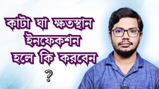 কাটা ঘা ক্ষতস্থান ইনফেকশন হলে কি করবেন ??  @DrMedicin