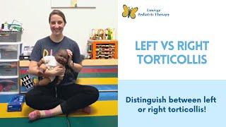 Left or Right Torticollis?