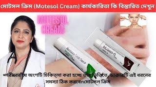 মোটসল ক্রিম Motesol Cream কার্যকারিতা কি বিস্তারিত দেখুন #treatment_medicine