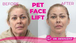 PET FACE LIFT - FULL PROCEDURE AND TESTIMONY - CG Cosmetic surgery