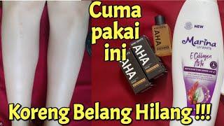 LOTION PEMUTIH BADAN PERMANEN  CARA CEPAT MEMUTIHKAN KULIT BELANG  MIMI WHITE AHA DAN MARINA