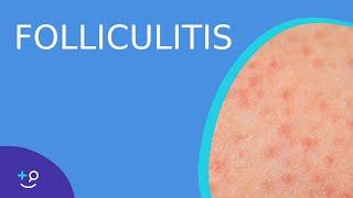 Folliculitis - Daily Dos of Dermatology