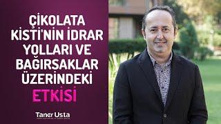 Çikolata Kistinin İdrar Yolları ve Bağırsaklar Üzerindeki Etkisi  Prof. Dr. Taner Usta