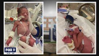 Newborn-mother bonding technique helps NICU baby grow  FOX 9 KMSP