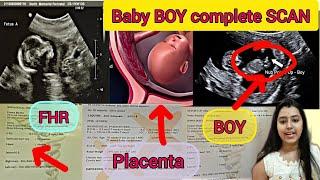My complete PREGNANCY scan Baby boy scan  Baby boy symptoms  #anomalyscan