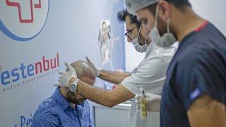 Sapphire FUE Hair Transplant Process - Hair Transplant in Turkey