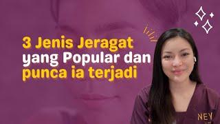 Beauty Tips  3 Jenis Jeragat yang Popular dan Punca ia Terjadi