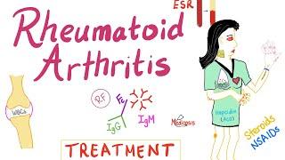 Rheumatoid Arthritis RA - Treatment and Management - Rheumatology Series