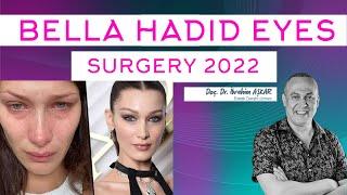 BELLA HADİD EYES SURGERY UPDATE 2022