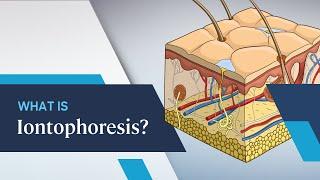 What is Iontophoresis?