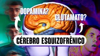 ESQUIZOFRENIA O que CAUSA?