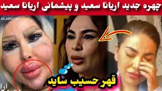 پیشمانی اریانا سعید بعد از جراحی صورت است و گریه ها اریانا سعیدAryana Sayeed