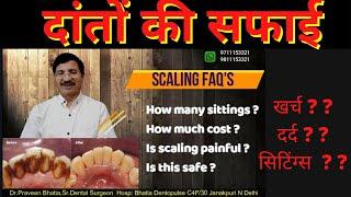 दांतों की सफाई-खर्च ? दर्द ? सिटिंग्स  ?CLEANING OF TEETH- FAQS COSTSittings  -Dr.Praveen Bhatia