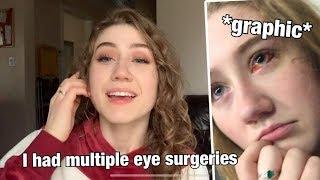 STORYTIME I HAD A RETINAL DETACHMENT AND NEEDED MULTIPLE SURGERIES AT 18 YEARS OLD