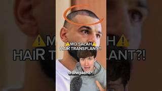 MO SALAH HAIR TRANSPLANT? ️ #shorts #football