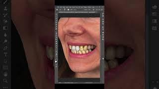 Teeth Whitening in Photoshop Easy Tutorial. #photoshop #photography