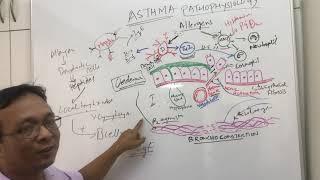 AsthmaBronchial AsthmapathophysiologyRefHarrisons Internal medicine and Robins pathology