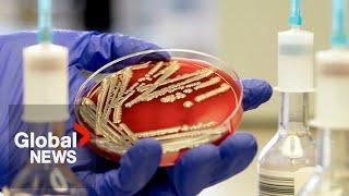 E. coli outbreak How to protect yourself from bacteria infection?