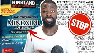 Why I STOPPED USING Minoxidil to Improve my Beard Growth - Dont use Minoxidil Before Watching This