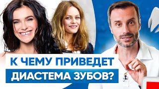 Как убрать щель между зубами? Диастема зубов – все что нужно знать