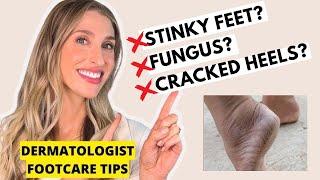 Footcare Tips for Cracked Heels Smelly Feet Toenail Fungus & More  Dermatologist Dr. Sam Ellis