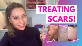 How To Treat Scars Flat Depressed Raised and Keloids  Dr. Shereene Idriss