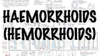 Haemorrhoids Hemorrhoids - Overview pathophysiology investigations and treatment