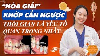 Trẻ Bị Khớp Cắn Ngược Nên Can Thiệp Tốt Nhất Ở Độ Tuổi Nào?  Nam Bui Vinalign