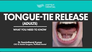 Tongue-Tie Release for Adults What You Need To Know FULL