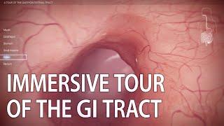 A Tour of the Gastrointestinal Tract  medical animation of GI tract