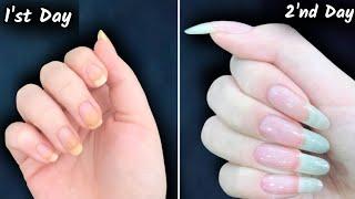 How to grow nails in 2 days  How to grow nails fast overnight  How to grow nails fast 