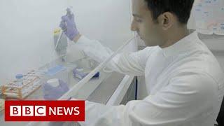 Science rejuvenates womans skin cells to 30 years younger - BBC News