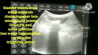 dog ultrasound  urinary bladder stones  or uroliths  or caliculi  appearance