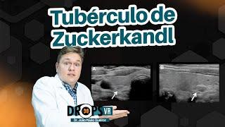 TUBÉRCULO DE ZUCKERKANDL - VARIAÇÃO ANATÔMICA QUE VOCÊ NÃO PODE DEIXAR DE SABER I VOCÊ RADIOLOGISTA